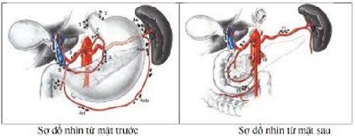 Nghiệm thu đề tài “Nghiên cứu ứng dụng phẫu thuật nội soi cắt dạ dày kèm vét hạch D2 kết hợp hóa-xạ trị trong điều trị ung thư dạ dày”